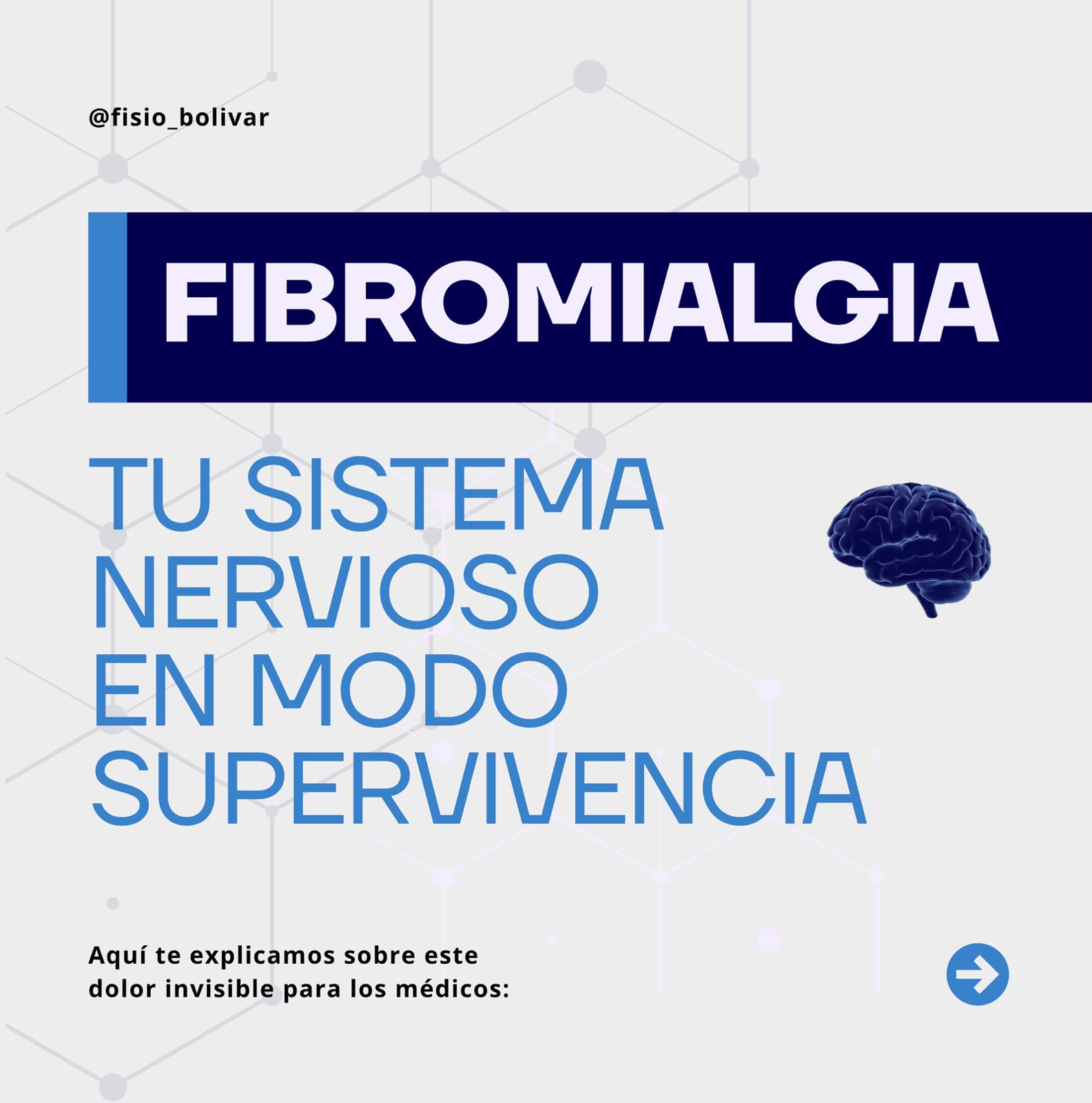 Fibromialgia