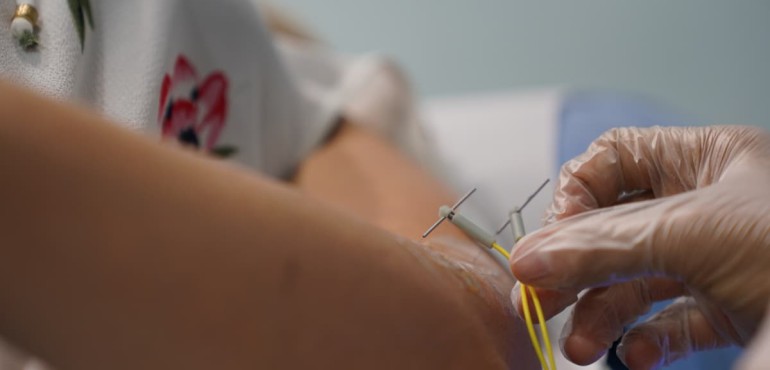 Neuromodulación Percutánea Ecoguiada (NMPE) en Palma